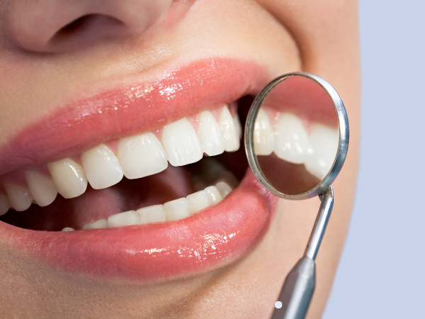 Teeth Cleaning Treatment In Amman